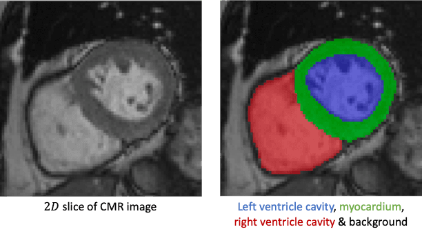 LVSegmenter: Left Ventricle Segmentation